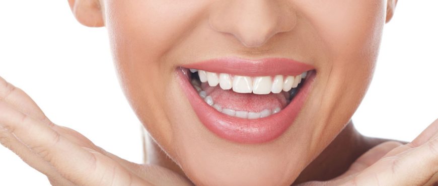Blanqueamiento Dental